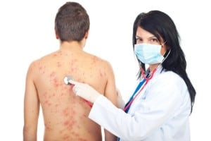 רשלנות רפואית בדלקת עור