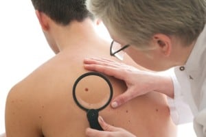 רשלנות רפואית בסרטן העור
